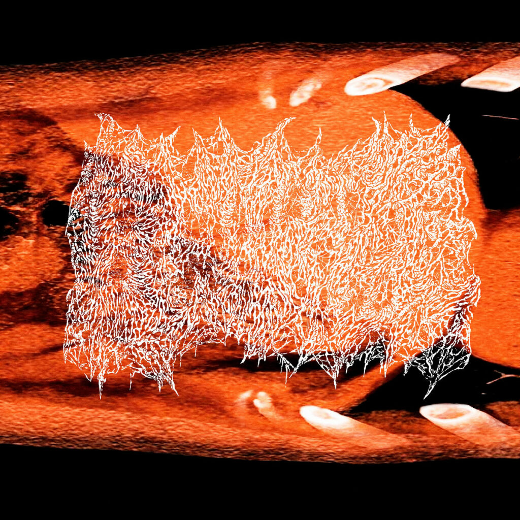 Beurre « Resonate And Amplify » (Humus Records/Jaune Orange Records, 5 septembre 2025)